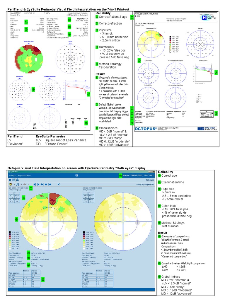 Octopus Visual Field Interpretation Guide | PDF