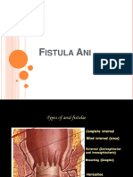 Fistula Ani