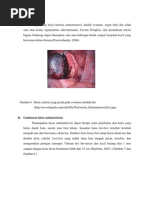 Download Patologi Endometriosis by Laurensia Erlina Natalia SN139415983 doc pdf