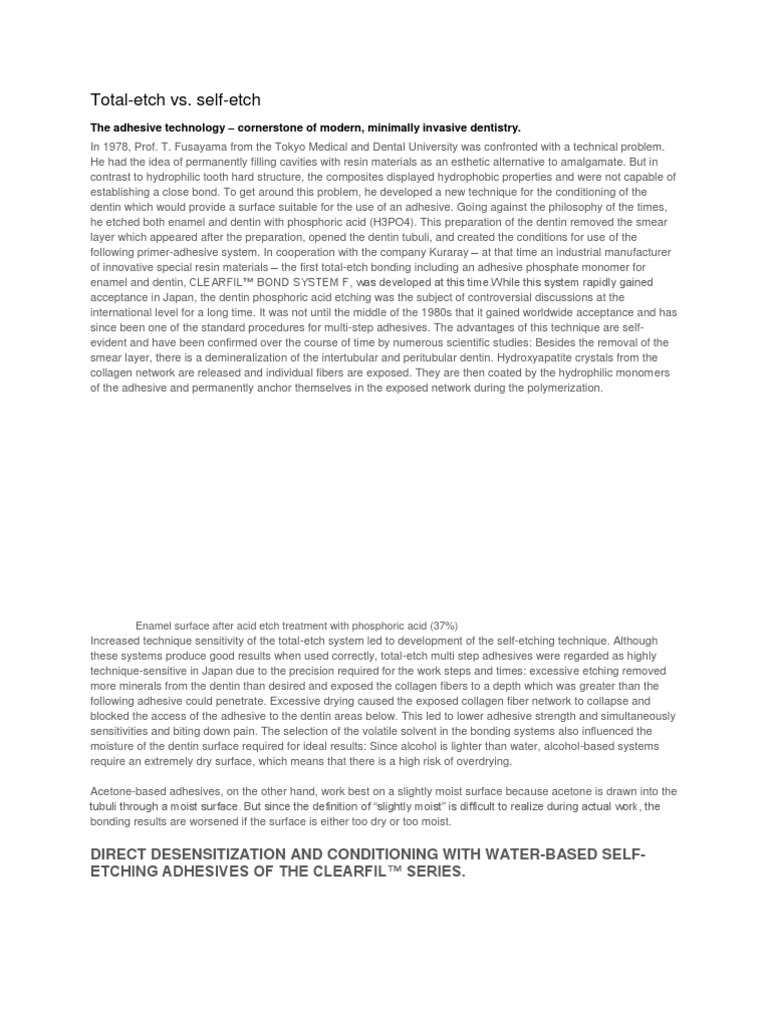 Total Etch vs Self Etch Tooth Enamel Adhesive