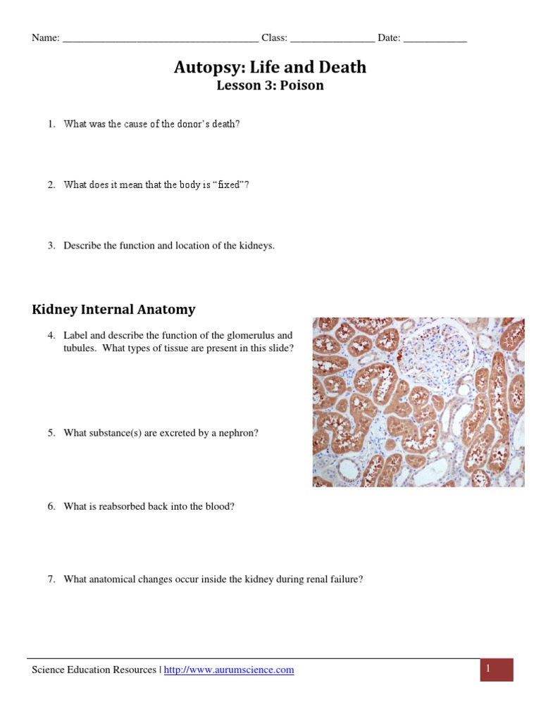 Autopsy: Life and Death - Lesson 3 | PDF | Autopsy | Kidney