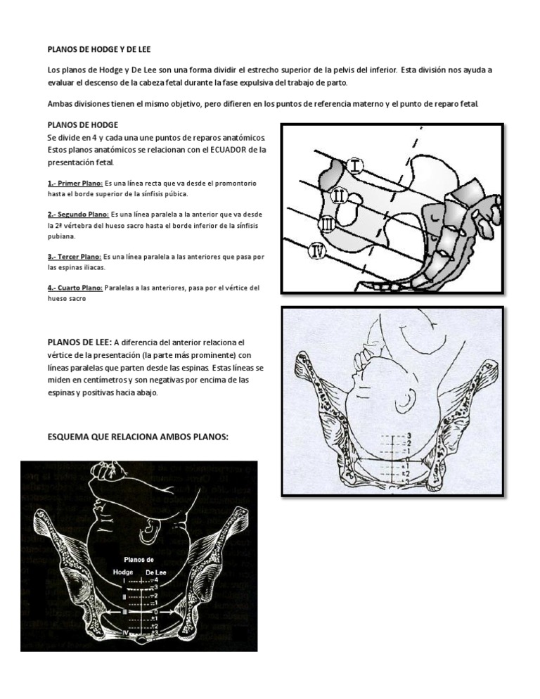 Planos de Hodge y de Lee