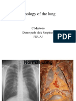 Pathology of The Lung: C.Murtono Demo Pada Blok Respirasi Fkuaj