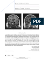 Pituitary Apoplexy - Image of NEJM