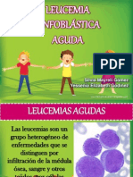 LEUCEMIA LINFOBLASTICA20131.pptx