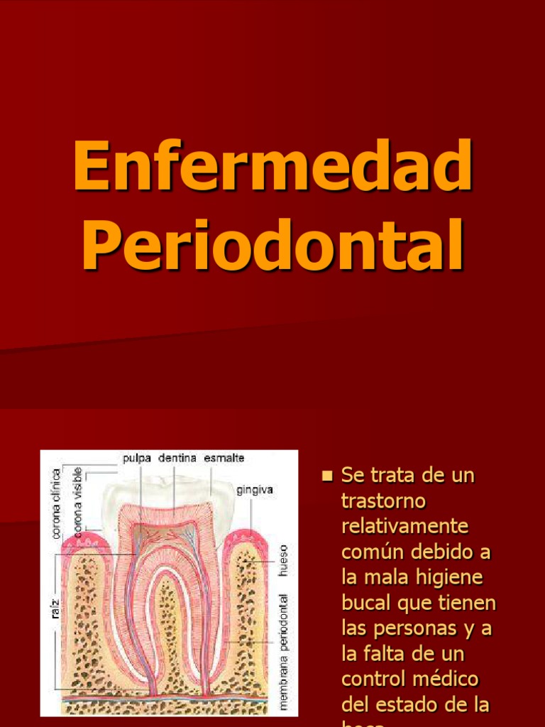 Enfermedad Periodontal | PDF | Diente humano | Odontología