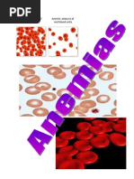 Download Anemias by Juan Carlos Vzquez SN14127817 doc pdf
