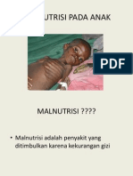 Penyuluhan _ Malnutrisi Pada Anak