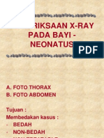 Pemeriksaan X-Ray Pada Bayi - Neonatus