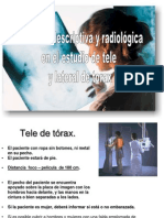 4.2 Anatomia Descriptiva y Radiológica en Tele y Lateral de Tórax