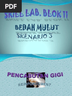 Download Pencabutan Gigi by Ardhana Harnash SN141623664 doc pdf