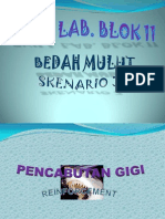 Pencabutan Gigi