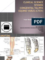 Congenital Talipes Equino Varus