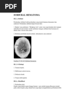 Subdural Hematoma 