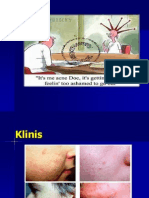 Acne Vulgaris 