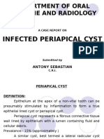 Infected Periapical Cyst 