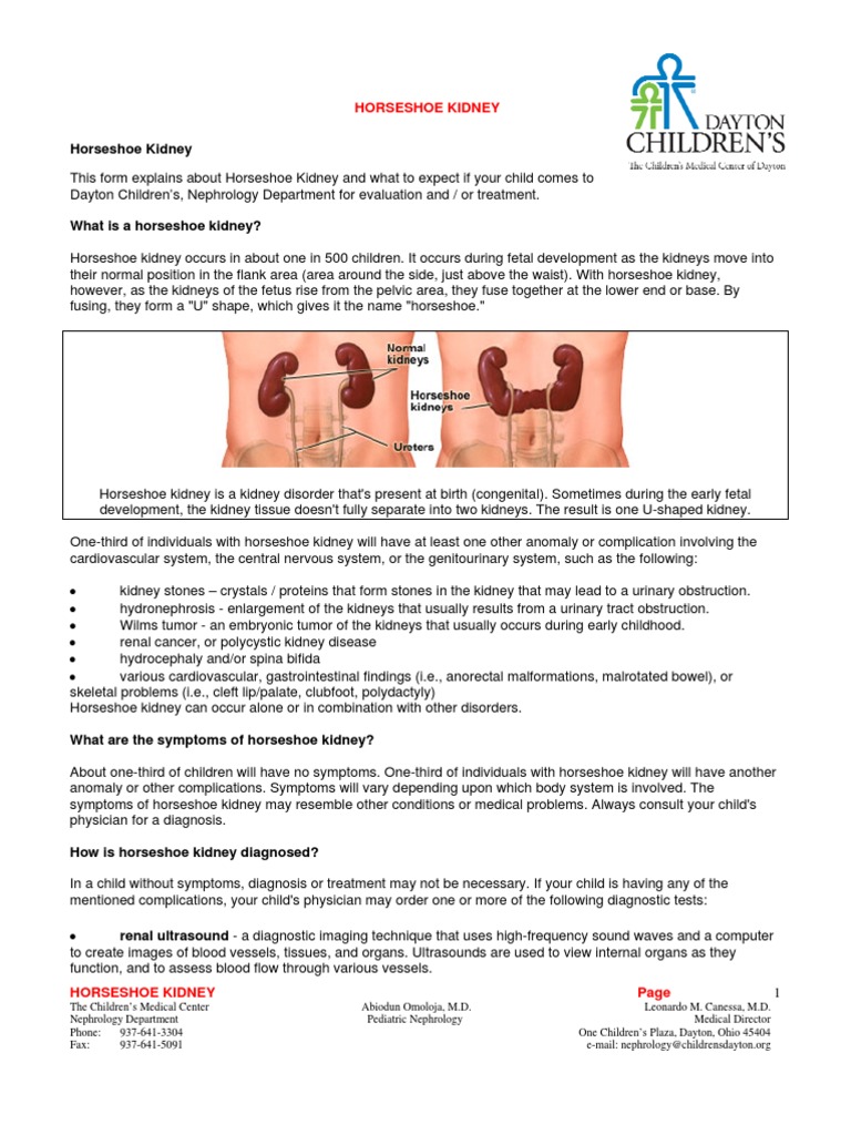 Complication of Horseshoe Kidney Congenital Disorder Kidney