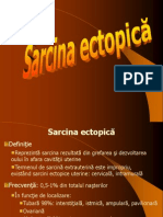 Sarcina Ectopica Mola