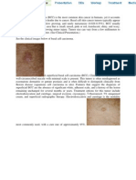 Basal Celfazil amrisl Carcinoma RWAESDDXCDSFDFS
