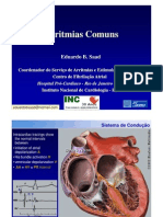 Arritmias Comuns: Diagnóstico e Tratamento