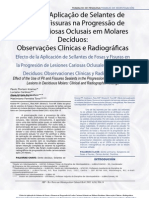 Efeito Da Aplicação de Selantes de Fóssulas e Fissuras