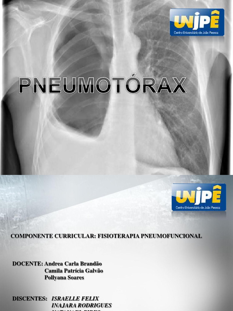 Pneumotorax Completo | PDF | Doenças e distúrbios | Pneumologia