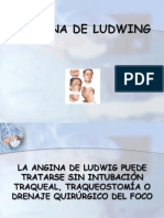 Angina de Ludwing