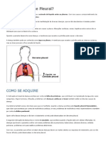 O que é Derrame Pleural