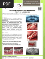 SUPRANUMERÁRIOS RETIDOS EM MANDÍBULA. RELATO DE CASO CLÍNICO