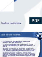 Cesárea y Eclampsia