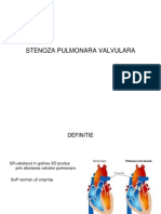 STENOZA PULMONARA - PPT