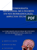 La Tomografa Helicoidal Multicorte en Neuro Definitivo