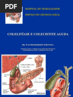 Aula Colelitiase e Colecistite Aguda