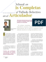 Tallado Selectivo en El Articulador