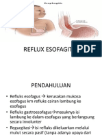 Reflux Esofagitis