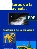 02clavicula Fractura Lux Ac CL 1226950783692324 8