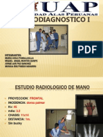 Estudio Radiologico de Mano (1)