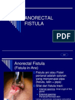 Fistula Ani