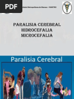 Paralisia Cerebral
