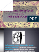 8.glomerulonefritis Aguda