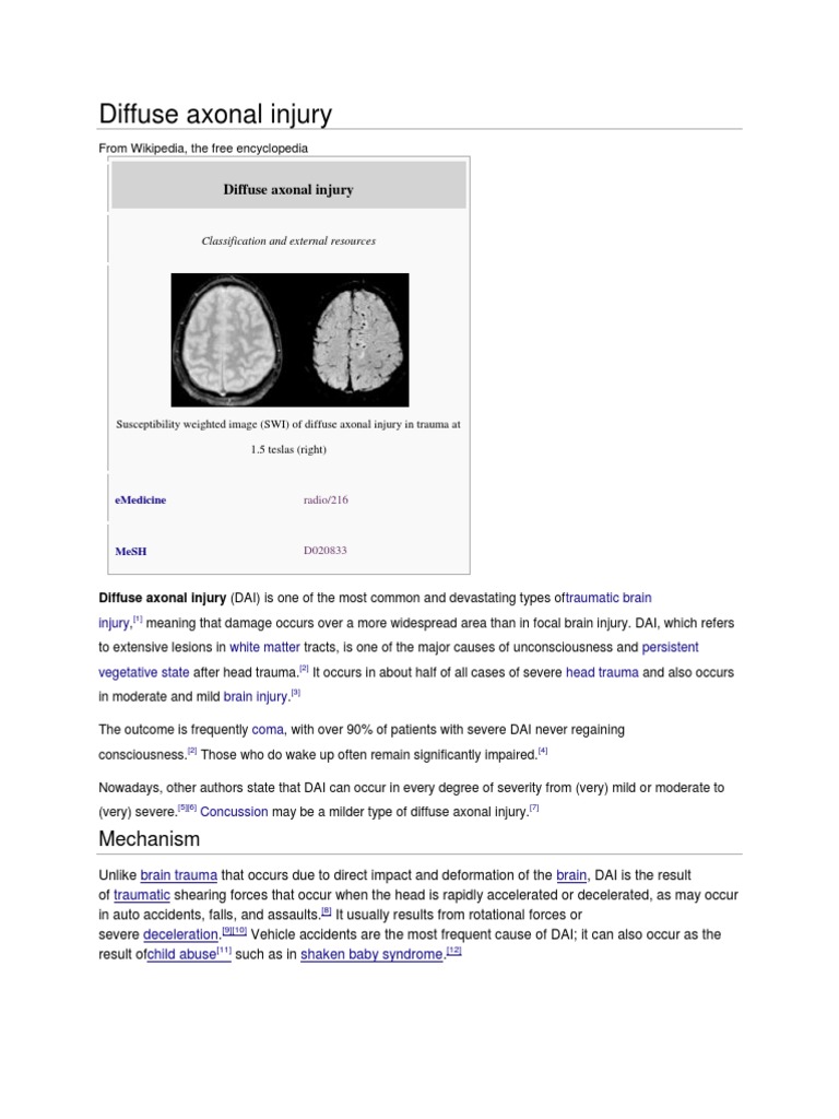 Diffuse Axonal Injury | PDF | Neuroanatomy | Clinical Medicine
