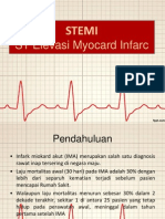 STEMI Fix