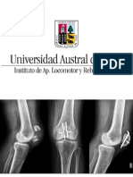 Fracturas y Osteosíntesis 3.11