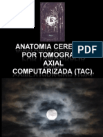 22532045 Anatomia Cerebral Por Tomografia Axial