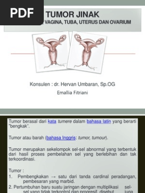 Xola onanizm bilan shug‘ullanayotganda qo‘lga tushdi