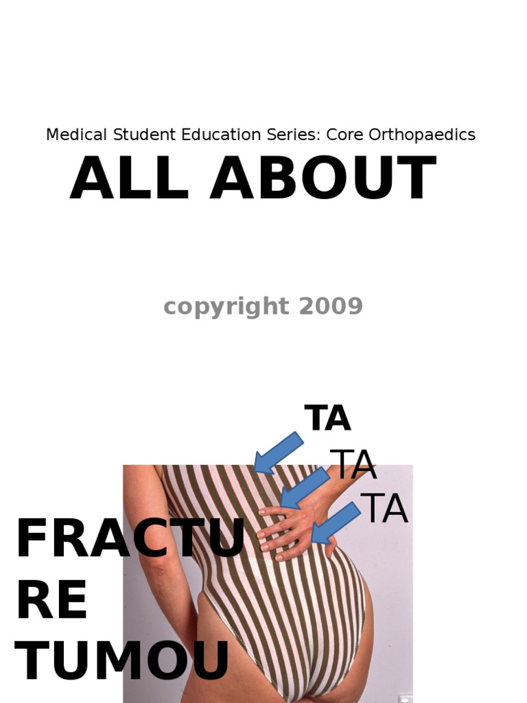 Back Pain | PDF