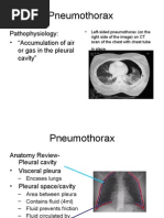 Pneumothorax