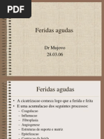 Feridas agudas (2).ppt