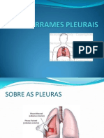 Derrames Pleurais