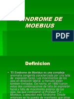 Sindrome Moebius